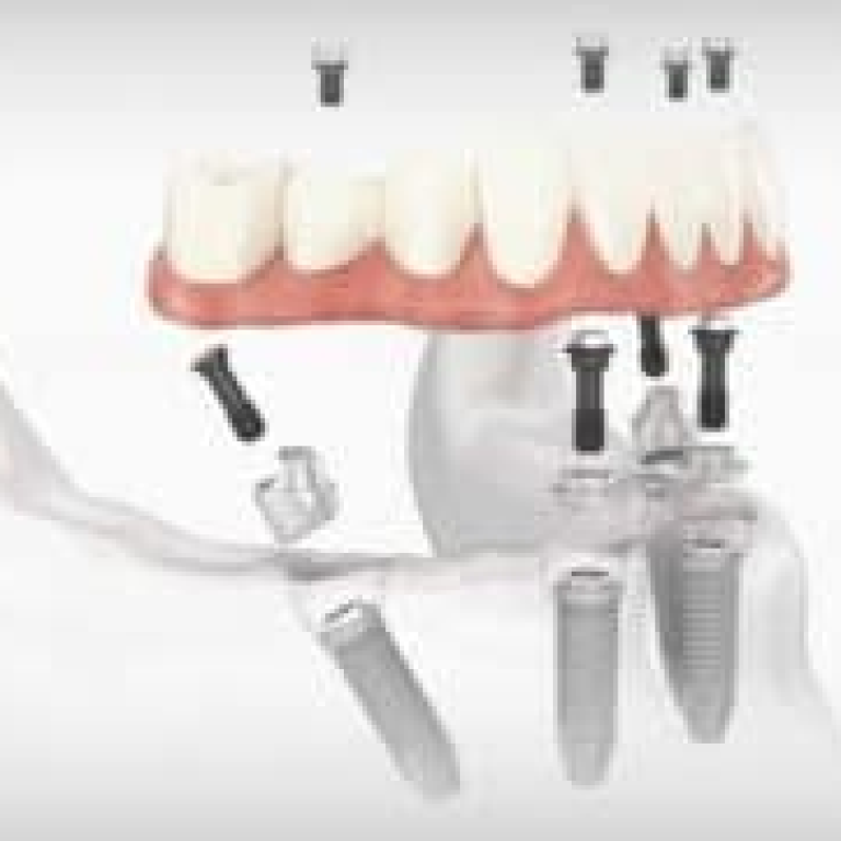 resim_2025-04-27_141425674